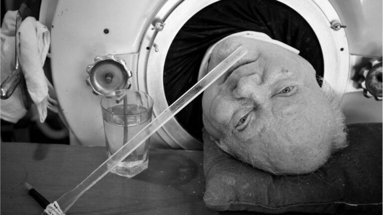 USA: 72 Jahre lebte er in der Eisernen Lunge – Paul Alexander ist tot